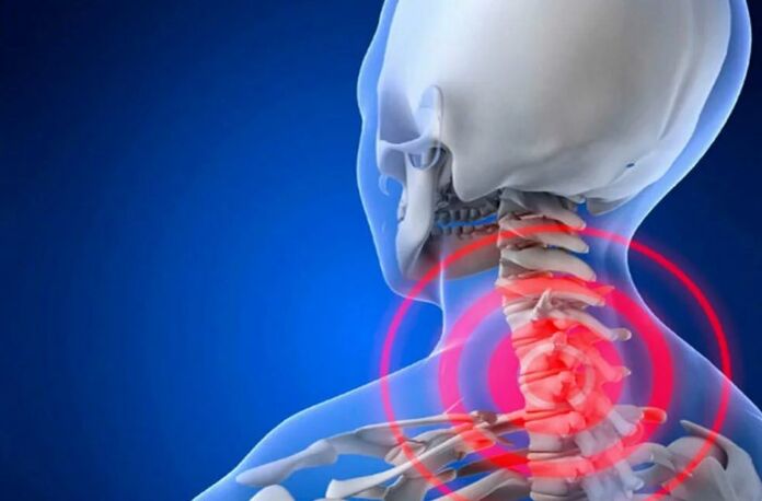 Osteocondrosis de la columna cervical