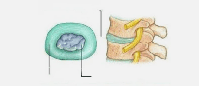 Naturaleza de la osteocondrosis