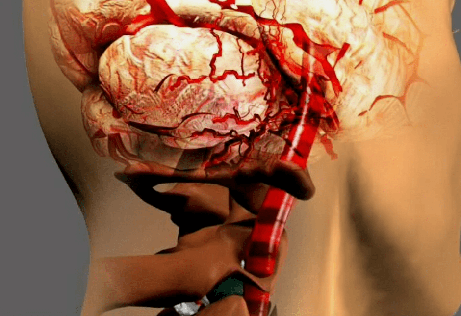 que la osteocondrosis cervical es peligrosa