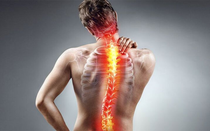 Dolor de espalda con escoliosis